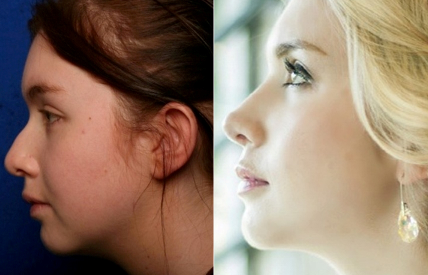 Kirsty Before and After