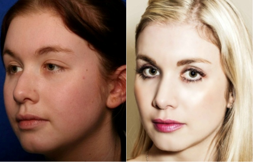 Kirsty Before and After